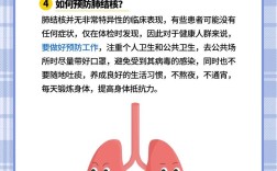 肺结核10个常识，你了解多少？