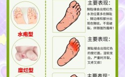 生活小常识如何巧治脚气？