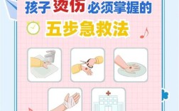 烧伤急救怎么做？关键常识有哪些？