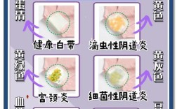 妇科疾病注意事项常识