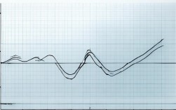 线形图英文作文如何写？关键步骤有哪些？