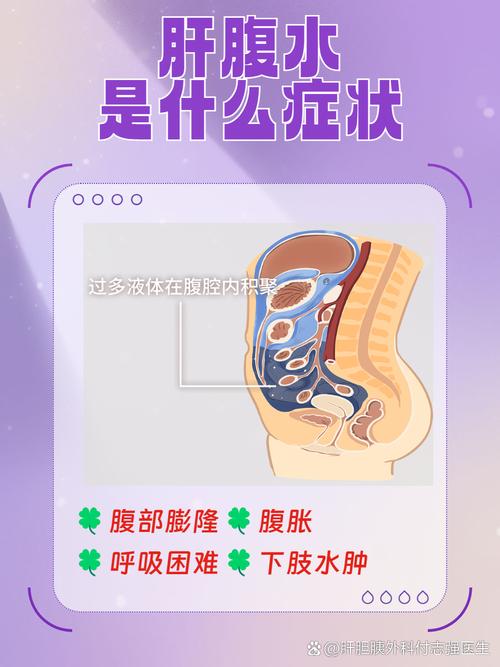 关于腹水的一些常识