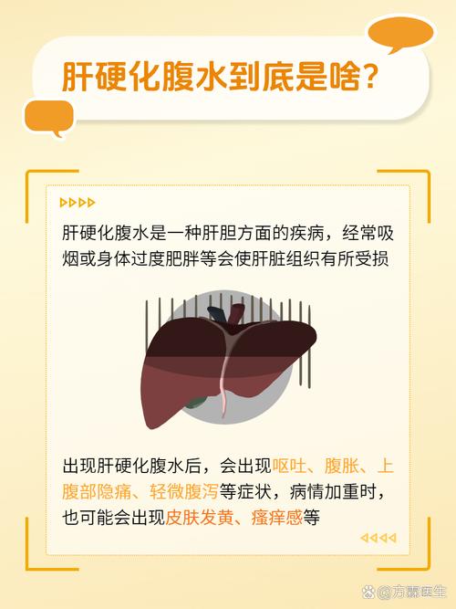 关于腹水的一些常识