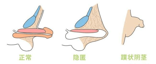 男生生殖器的常识