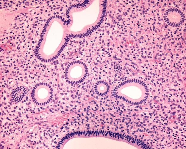 妇科疾病常识与营养保健