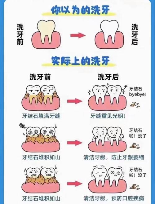 口腔卫生常识100条