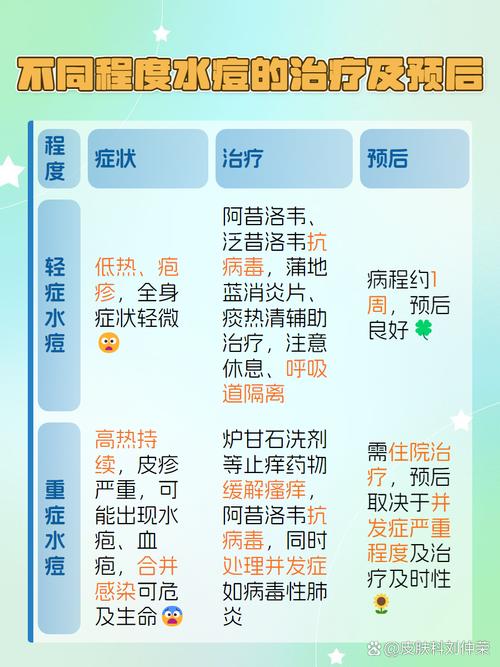 预防水痘病小常识