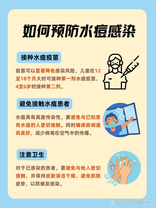 预防水痘病小常识