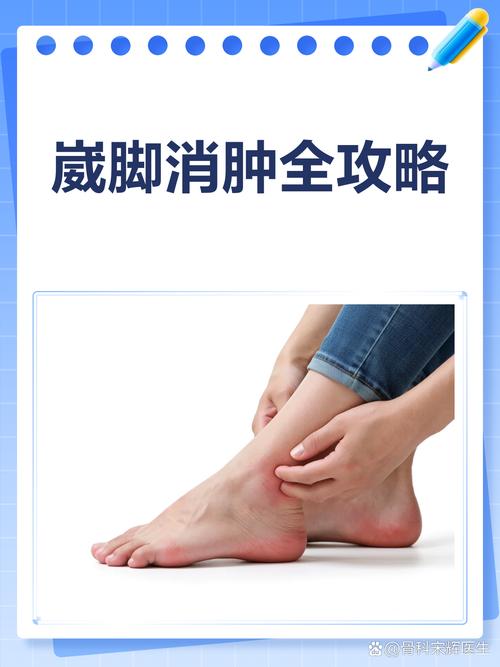 脚腕消肿生活小常识