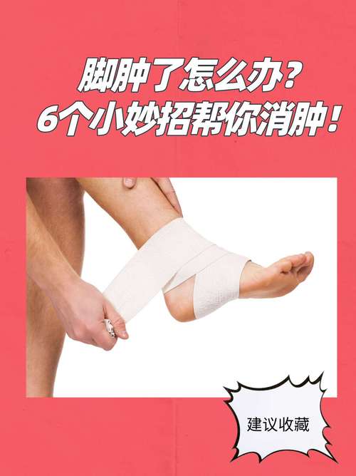 脚腕消肿生活小常识