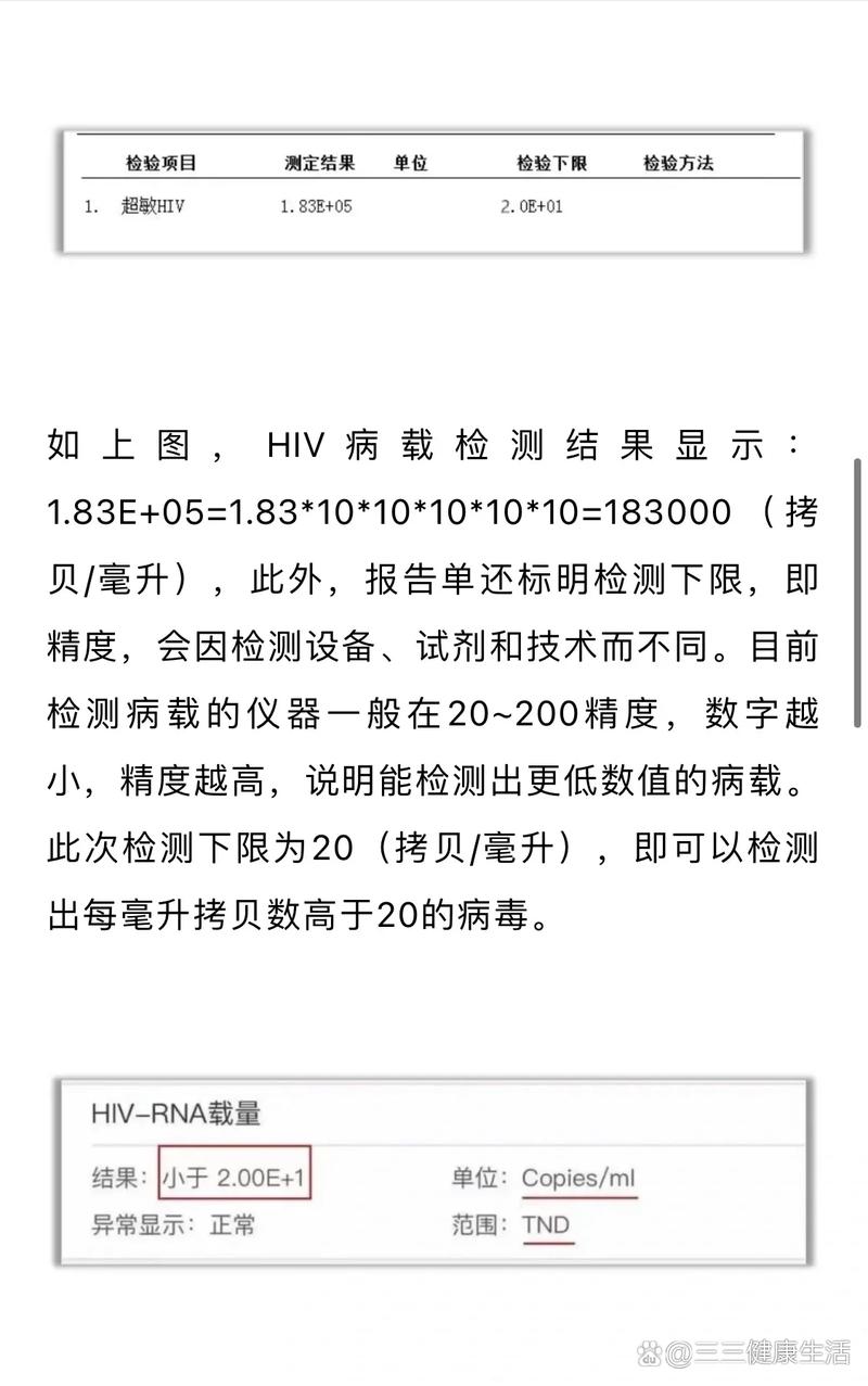 hiv基本常识病毒量