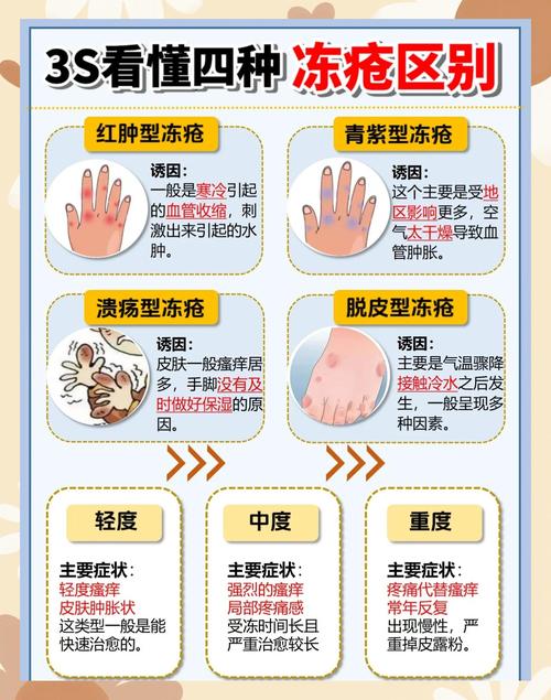 防治冻疮安全教育