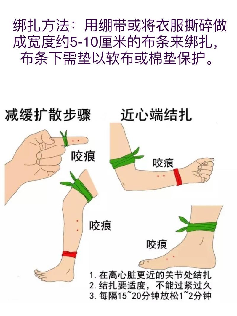 蛇虫咬伤的处理常识