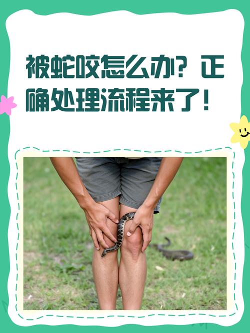蛇虫咬伤的处理常识