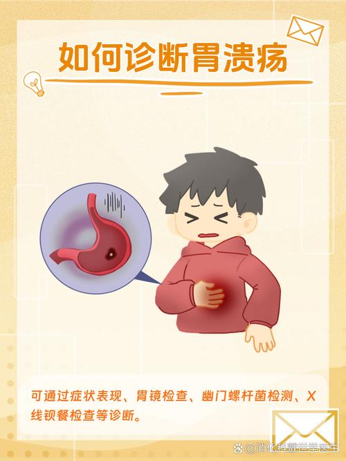 消化性溃疡生活常识